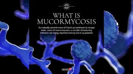 Mucormycosis | 20 victims of mucomycosis in Pune, how many patients in which district?